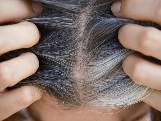 Hair Graying